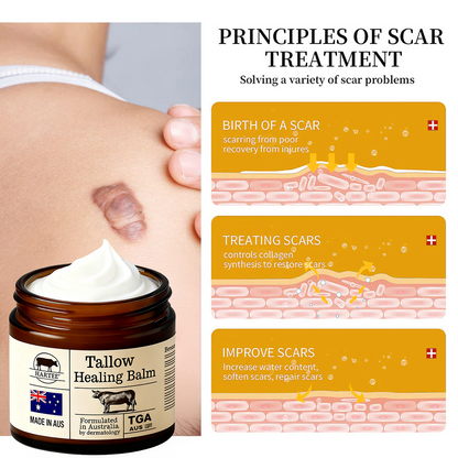 HARTEE® Tallow Healing Balm🐄（GMP Facility • TGA-Registered • Dermatologist Tested👨‍⚕️）Soothe eczema, psoriasis & rosacea—without steroids.🐄