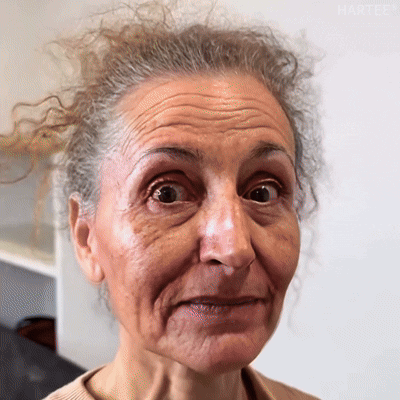 HARTEE® Tallow Healing Balm🐄（GMP Facility • TGA-Registered • Dermatologist Tested👨‍⚕️）Soothe eczema, psoriasis & rosacea—without steroids.🐄