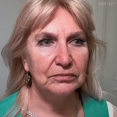 HARTEE® Tallow Healing Balm🐄（GMP Facility • TGA-Registered • Dermatologist Tested👨‍⚕️）Soothe eczema, psoriasis & rosacea—without steroids.🐄