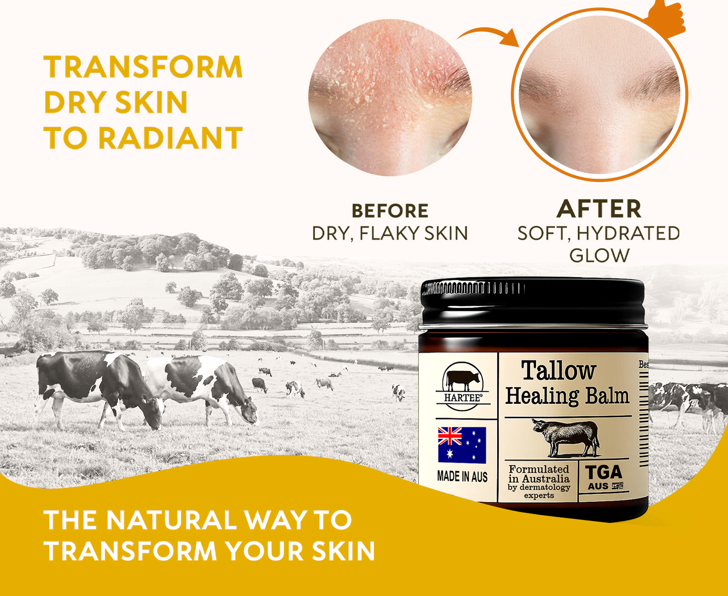 HARTEE® Tallow Healing Balm🐄（GMP Facility • TGA-Registered • Dermatologist Tested👨‍⚕️）Soothe eczema, psoriasis & rosacea—without steroids.🐄
