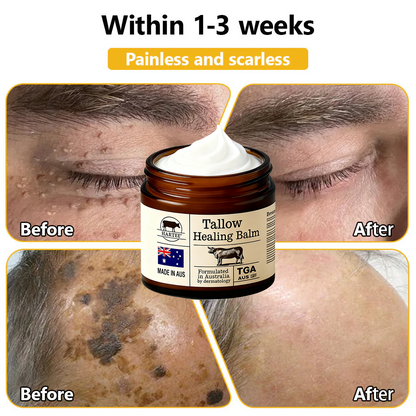 HARTEE® Tallow Healing Balm🐄（GMP Facility • TGA-Registered • Dermatologist Tested👨‍⚕️）Soothe eczema, psoriasis & rosacea—without steroids.🐄