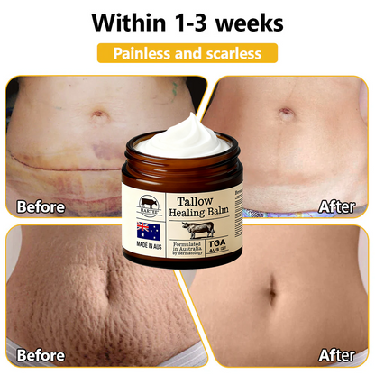 HARTEE® Tallow Healing Balm🐄（GMP Facility • TGA-Registered • Dermatologist Tested👨‍⚕️）Soothe eczema, psoriasis & rosacea—without steroids.🐄